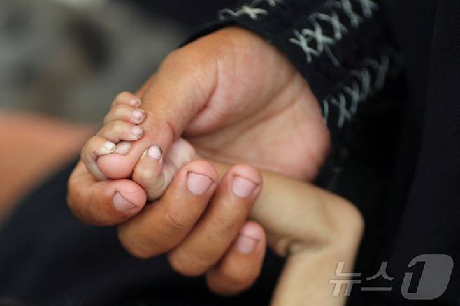 8월 5일(현지시간) 팔레스타인 가자지구 가자시티에서 한 어머니가 영양실조로 쇠약해진 생후 5개월 자녀의 손을 잡고 있다. 2025.08.05. ⓒ 로이터=뉴스1 ⓒ News1 윤다정 기자