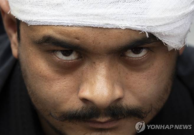 지난 달 21일(현지시간) 'Z세대 주도 시위' 도중 다친 네팔 주민 [EPA 연합뉴스 자료사진. 재판매 및 DB 금지]