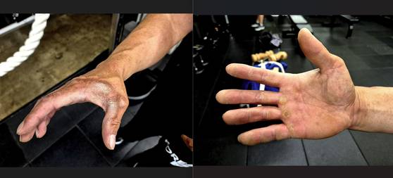 팔씨름 선수로 활동 중인 경남 김해시청 공원과 실무관인 서상진(55)씨의 손에 굳은살이 잔뜩 박여 있다. 안대훈 기자