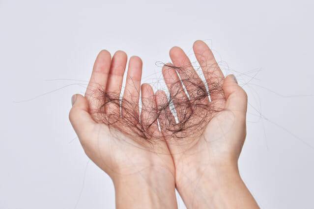 탈모 자료 사진(제공=클립아트코리아)