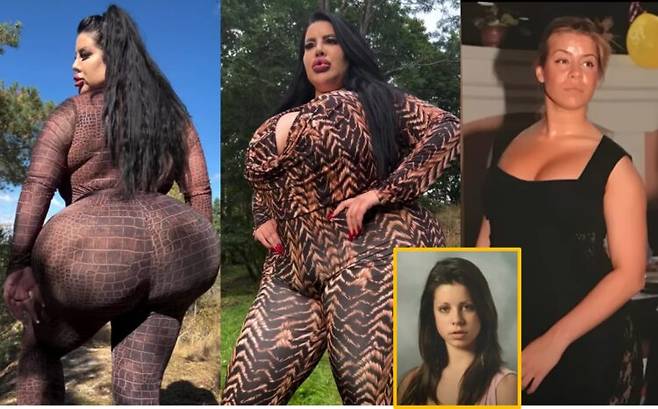 세르비아 출신의 한 모델이 '세계에서 가장 큰 엉덩이'를 만들기 위해 5회에 걸쳐 45kg의 지방을 넣었다 밝히면서, 그의 시술 전 모습도 공개돼 화제가 되고 있다. 가장 우측 상하단 모습이 시술 전 모습. 사진=유튜브