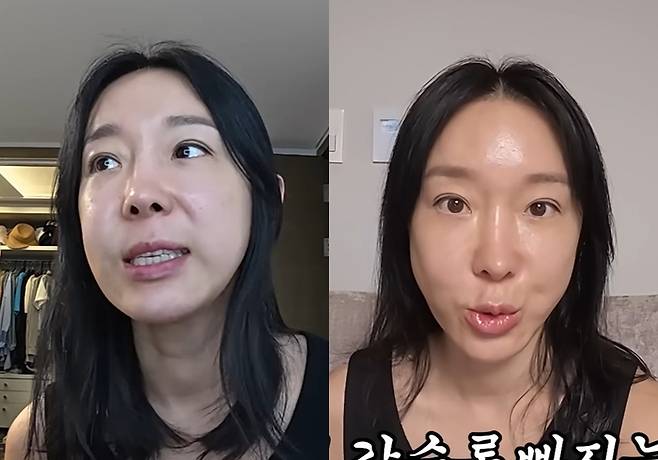 이지혜 실리프팅 전, 후. 사진| 유튜브