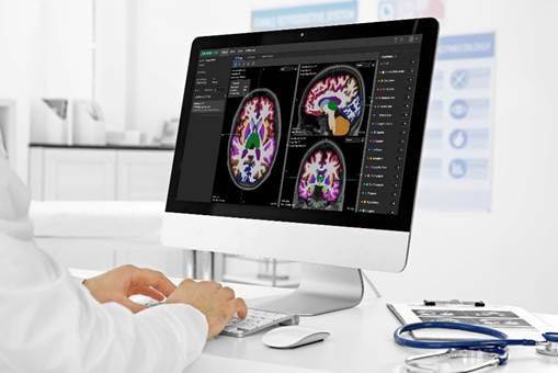 AI 기반 뇌 질환 진단 소프트웨어 뉴로핏 아쿠아. /뉴로핏