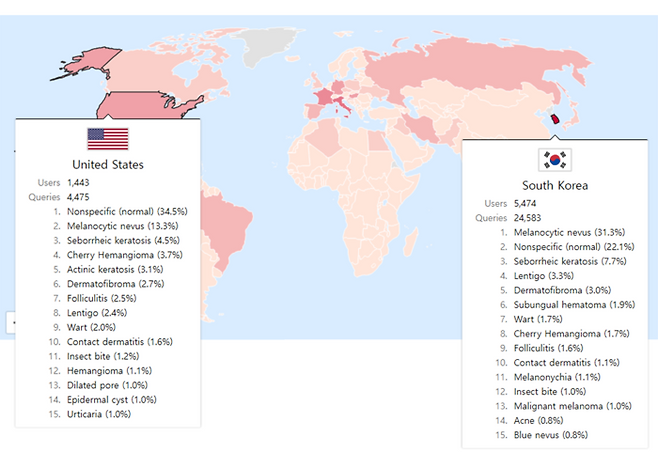 stat.modelderm.com에서 공개하는 실시간 국가별 피부질환 발병과 관심도 현황. 제공=분당서울대병원