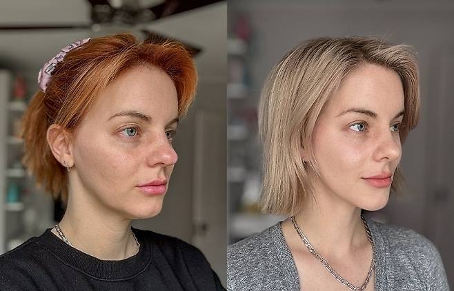 Images comparing Heidi Mae’s appearance before and after her face-lift, nose surgery and skin procedures. (Courtesy of Heidi Mae)