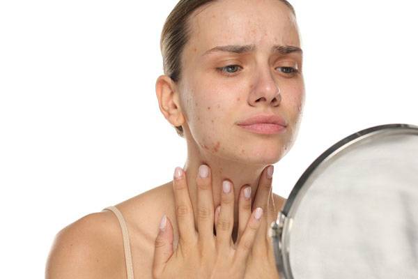 정신건강에 문제가 있는 사람은 피부질환을 함께 겪을 가능성이 높다는 연구 결과가 나왔다./사진=게티이미지뱅크