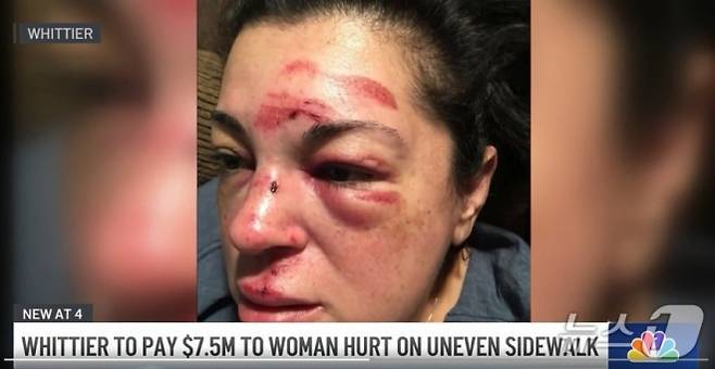 사고 당시 부상을 입은 저스틴 구롤라의 모습. NBC 로스앤젤레스·뉴스1