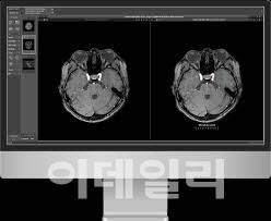 딥노이드 엑스레이 AI 분석 제품 모습 (사진=딥노이드)