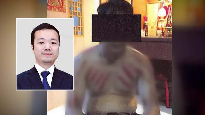 천즈의 “죽지 않을 만큼만 때리라”는 지시에 따라 폭행당한 조직원 (출처: 미 법무부 공소장)