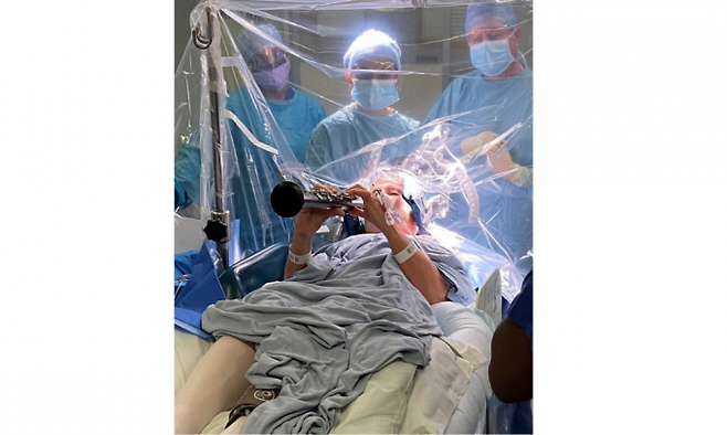 파킨슨병 환자 데니스 베이컨이 뇌에 전극을 심어 전기 자극을 주는 ‘심부뇌자극술(DBS)’을 받으며 클라리넷을 연주하고 있다. 전류가 흐르자 굳어 있던 손가락이 즉시 풀리며 연주가 이어졌다. 킹스칼리지병원 제공