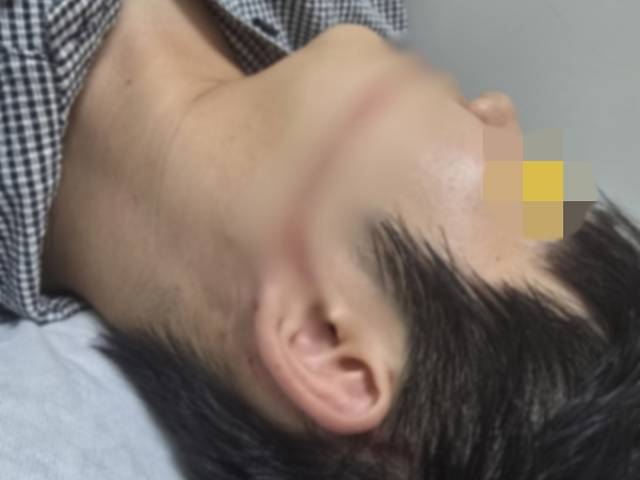 안산시 물축제에서 워터건에 맞아 다친 피해자. 연합뉴스