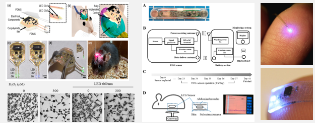 광자극 기반 인체삽입형 알츠하이머 센서. 이종하 교수 제공