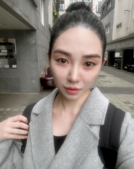 ▲ AOA 출신 권민아. 출처| 권민아 SNS