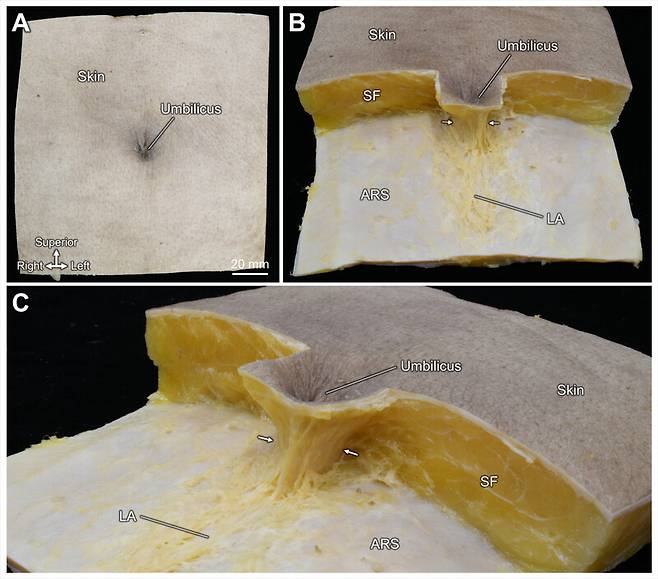 배꼽과 배꼽을 감싸고 있는 원통형 구조. 도쿄과학대 제공