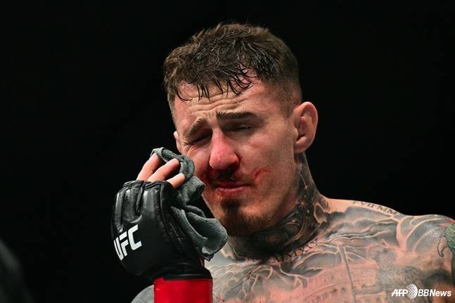 톰 아스피날이 시릴 가네와 경기 중 눈을 찡그리며 고통스러워하고 있다. /AFPBBNews=뉴스1