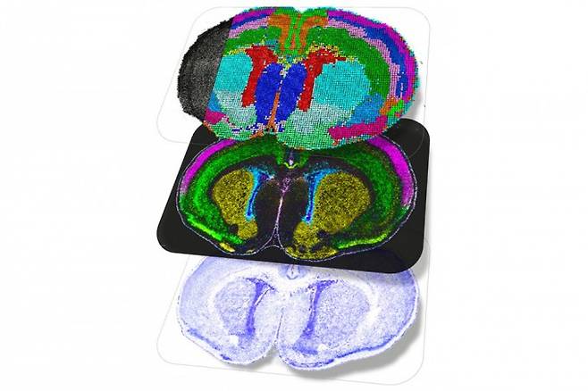 출생 직후 쥐의 뇌 공간 지도. 단백질이나 리보핵산(RNA) 등이 실제로 뇌의 어느 위치에서 상호작용하는지 보여준다. Zhang et al.(2025)/Nature 제공