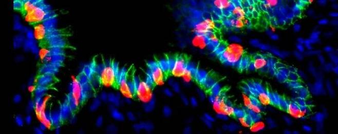 인슐린 분비하게 유전자 조작된 인간 위 오가노이드(hGO-NPM). Hyunkee Kim/Harvard University 제공