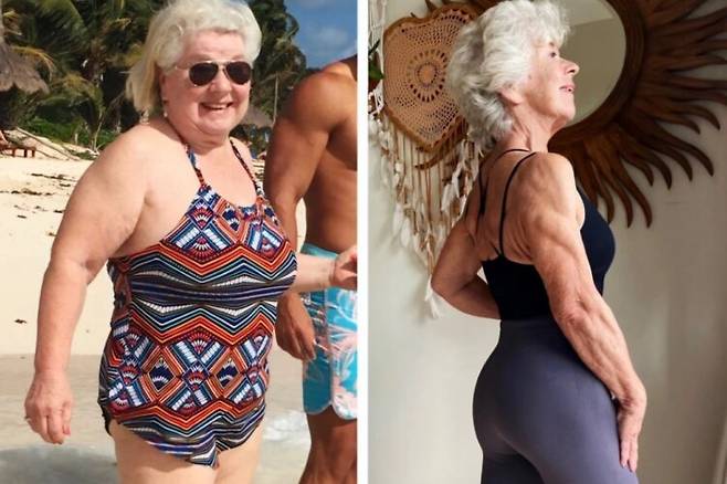 곧 80대가 되는 한 할머니가 체중 90kg에서 30kg을 뺀 후 골밀도까지 20대 수준으로 건강해진 사연을 공유했다. 체중 변화 전후 사진 = 조앤 맥도널드 SNS