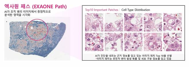 LG '엑사원 패스'는 병리 진단 과정에서 암과 관련된 유전자 변이를 예측할 수 있다./사진=LG AI 연구원