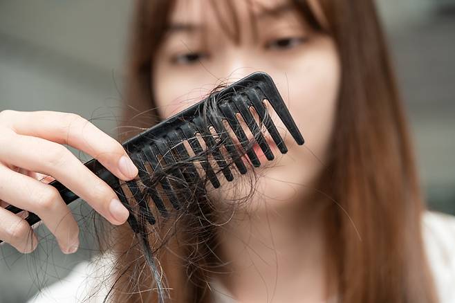 탈모. 기사와 직접적인 관련 없는 사진 [게티이미지]