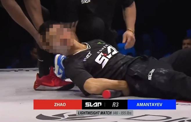 상대선수의 타격 한방에 오른쪽 광대뼈가 함몰된 자오훙강. X(구 트위터)