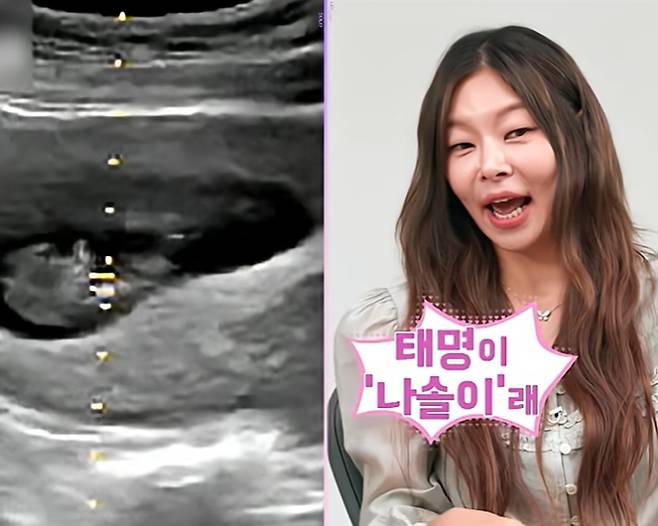 ENA와 SBS Plus의 리얼 데이팅 프로그램 '나는 솔로' 28기가 12일 밤 10시 30분, 100분 특별 편성으로 대망의 최종 선택을 공개한다. 이번 방송에서는 '솔로나라 28번지'의 최종 커플 결과와 함께, 초미의 관심사였던 '나는 솔로 28기 나솔이 아빠'의 정체가 마침내 밝혀진다. 앞서 정숙이 엄마임이 공개된 가운데, MC들조차 예상치 못한 인물이 아빠로 밝혀지면서 스튜디오가 충격에 빠졌다고 전해졌다. 역대급 반전과 기록이 예고된 만큼, '나는 솔로 28기 나솔이 아빠'가 누구일지 시청자들의 궁금증이 최고조에 달했다.​