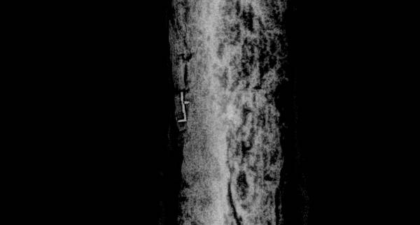 X선 촬영으로 새로 확인된 상감명문대도 1번 글자 '上'(원래 위치에서 이탈). /국립김해박물관