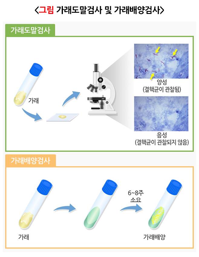 결핵 의심 환자에게서 결핵을 검출하기 위한 가래 도말·배양 검사 단계. /자료=질병관리청