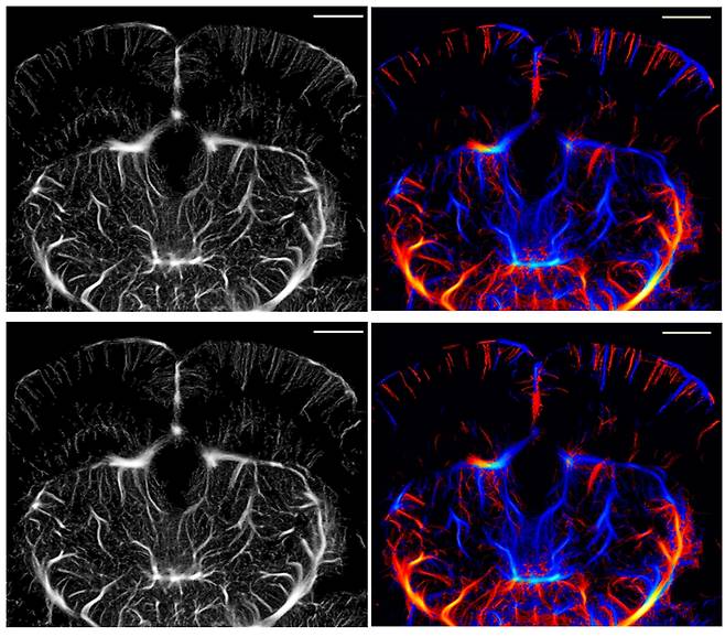 기존 ULM으로 획득한 쥐 뇌 모세혈관 영상(위)과 개발된 ULM-Lite 기법으로 획득한 모세혈관 영상(아래).[DGIST 제공]
