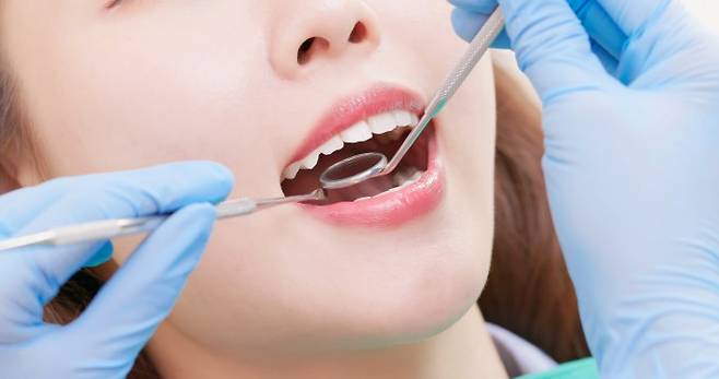 치과 진료를 받는 모습. 근관치료는 치아 신경, 혈관, 결합 조직을 포함하는 내부 조직인 치수(pulp) 감염이나 손상을 치료하는 흔한 치과 시술이다. 근관치료가 혈당 수치를 낮추고 염증 반응 등을 줄일 수 있다는 연구결과가 나왔다. 게티이미지뱅크 제공