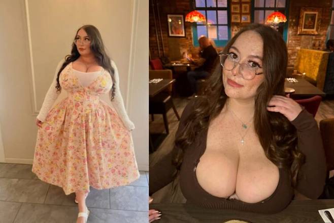 유방이 계속 커지는 거대유방증을 앓는 한 25세 여성의 사연이 전해졌다. 사진=SNS