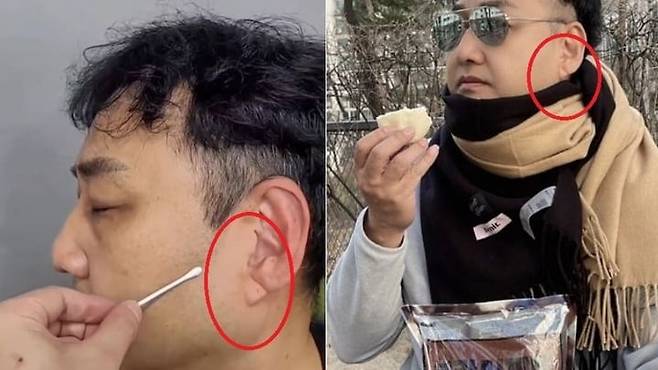 김수용 귓볼 주름