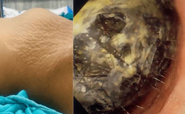 큐레우스(Cureus) 캡처.