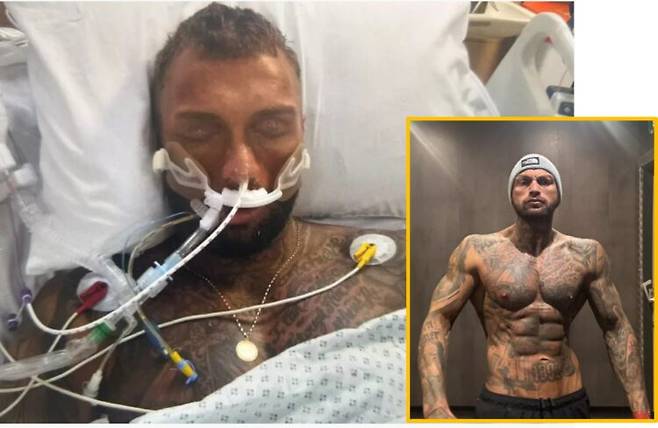 한 보디빌더가 매달 약 120만원을 들여 스테로이드 주사를 놓고 중독에 빠졌다가 혼수 상태까지 이른 사연을 전했다.  사진=잭의 SNS