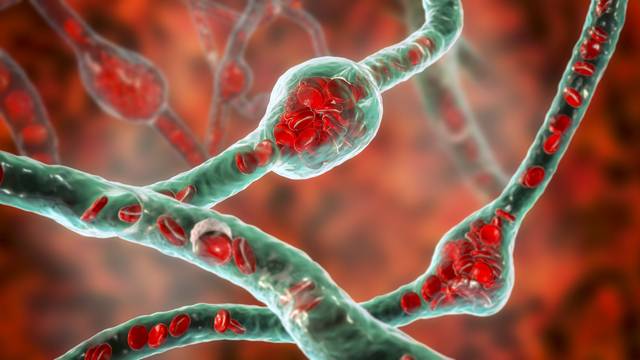 혈전용해제나 혈압약을 복용 중이라면 올리브오일 섭취 전 반드시 의사와 상담해야 한다. 사진은 기사의 특정 사실과 관련 없음. 클립아트코리아
