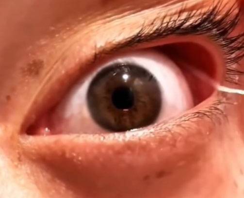 실눈곱은 눈에서 나오는 점액이 뭉쳐 생기는 것으로, 투명하거나 흰색을 띠며 끈적한 실 형태다./사진=인스타그램 'biology.zip' 캡처