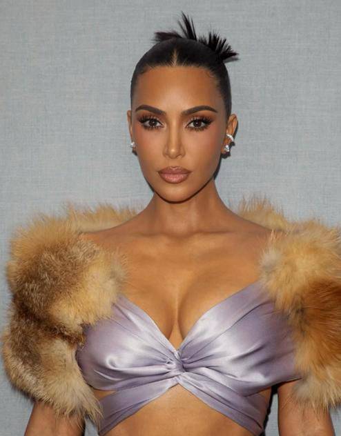 부유한 지역일수록 염증성 피부 질환인 건선 발병률이 더 높아진다는 연구 결과가 나왔다./사진=킴 카다시안 인스타그램