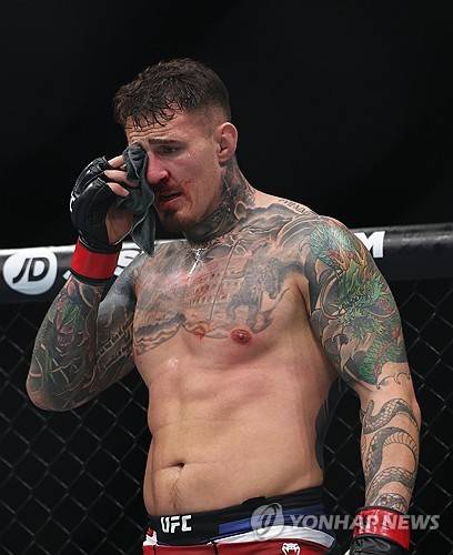 경기 중 눈을 다친 톰 아스피날 [EPA 연합뉴스]