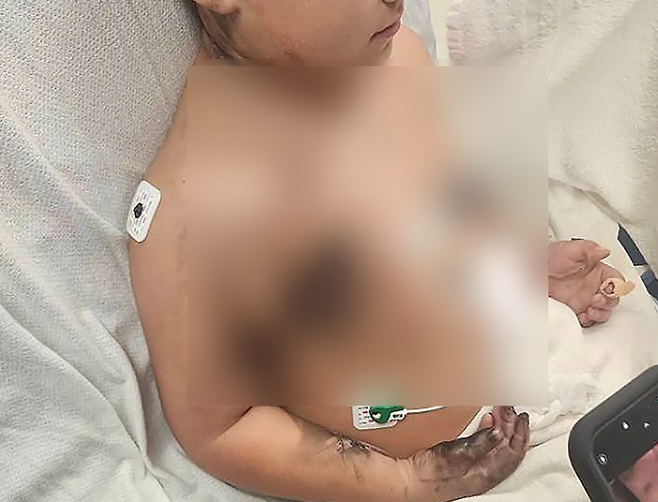 미국에서 8세 소년이 스마트폰을 충전한 채 잠들었다가 감전 사고를 당하는 사건이 발생했다. 고펀드미