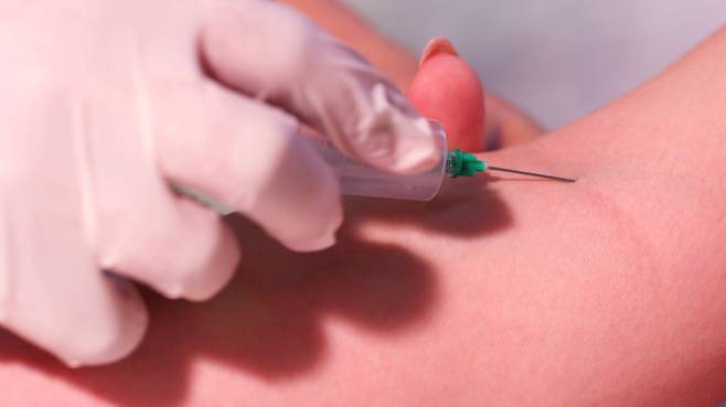 5세대 실손의료보험의 연내 출시 불발 가능성이 커졌다. 정확한 보험료 산출을 위해 연간 1억6000만건의 실손 영수증을 전수 분석하고, 급여·비급여 구분 없이 100% 지급했던 1세대 실손의 항목별 지급액을 수작업으로 분리해야 하는 등 실무 작업이 복잡하기 때문이다. 감독규정 개정 절차와 업계 준비 상황을 고려하면 내년 4월에 출시될 가능성도 점쳐진다. [게티이미지뱅크]