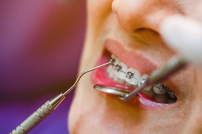 치과 치료 관련 사진. 게티이미지뱅크