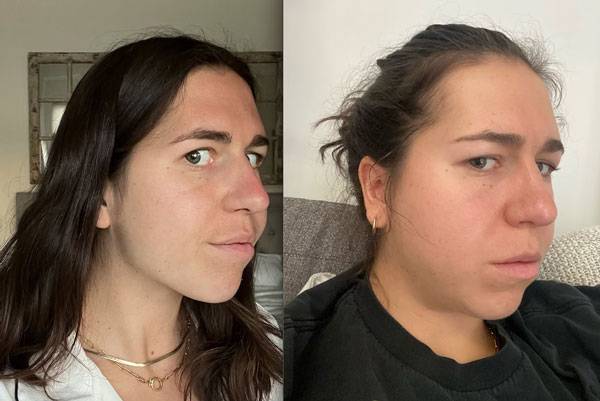 한 20대 여성이 의사의 오진으로 말단비대증을 제때 치료받지 못한 사연이 전해졌다. /사진=워싱턴 포스트