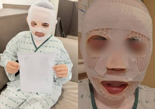한국인 남성이 자신의 여자친구인 태국인 여성의 얼굴이 끓는 물을 부은 사건이 알려져 논란이 되고 있다. (사진=페이스북 캡처)