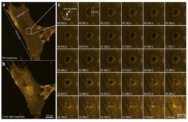 췌장암 조직에 집속 초음파를 가할 경우 일시적으로 세포내 진공(케비테이션)이 발생(A)하면서 세포막에 구멍이 생겼다가 사라지는 과정을 전자현미경으로 촬영(B, C는 확대한 장면)한 것. 아이엠지티 제공