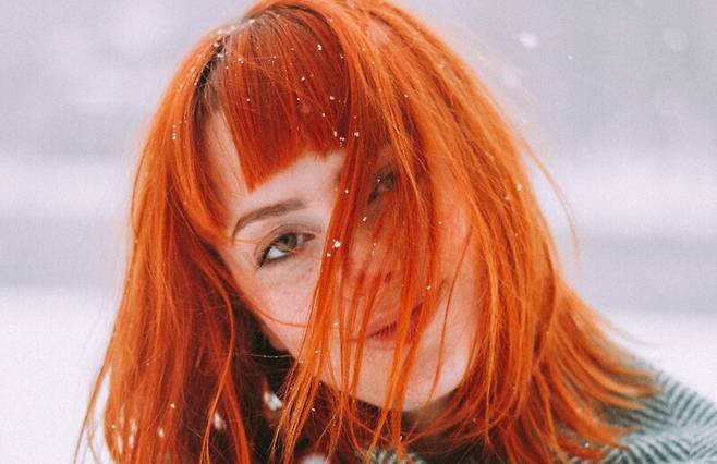 빨간 머리에 관여하는 유전자 MC1R이 염증에도 관여하는 것으로 밝혀졌다. Rodolfo Sanches Carvalho/Unsplash