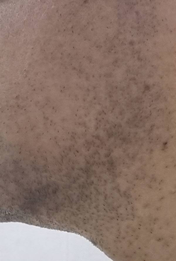 면도하기 전 모습. 면도 한 후 약 12시간 지났을 때다. 정옥재 기자