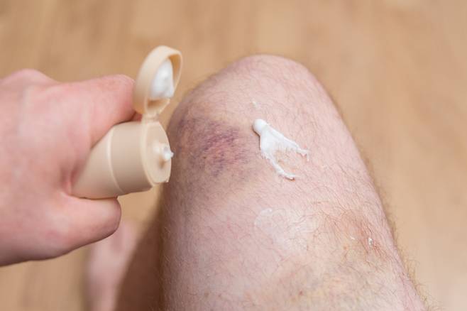 비타민K는 혈액응고를 도와주고 모세혈관의 결합조직을 강화시켜 혈관 벽을 튼튼하게 한다. 사진= 게티이미지뱅크