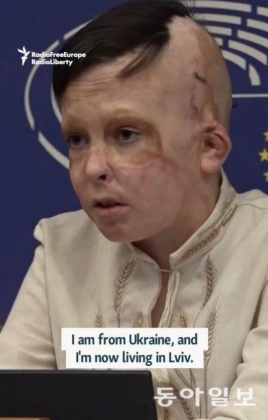 러시아군의 공습으로 크게 다쳐 총 36번의 수술을 받은 11세 우크라이나 소년 로만 올렉시우가 10일(현지 시간) 벨기에 브뤼셀의 유럽의회에서 어머니를 잃은 순간에 대해 증언하고 있다. 그는 2022년 7월 14일 러시아군의 공습때 눈앞에서 어머니를 잃었고, 자신도 심각한 화상을 입었다. 사진 출처 자유유럽방송(RFE/RL) 유튜브