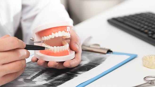 임플란트 시술 전 의료진과의 충분한 상담 필요｜출처: 게티이미지뱅크