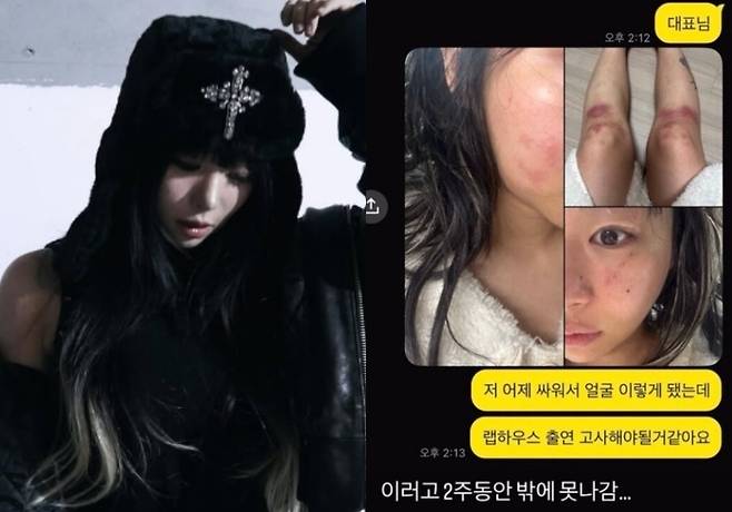 재키와이(왼), 재키와이가 공개한 폭행 흔적 사진. 사진|AOMG, 재키와이 SNS
